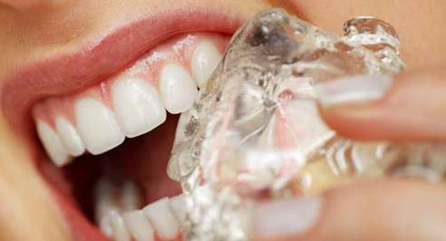 هل تدركين مخاطر المثلجات على أسنانك؟