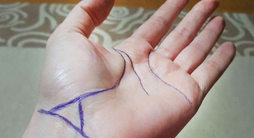 دلالة وجود شكل مثلث على معصم اليد