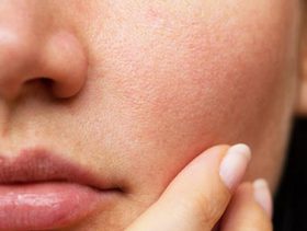 ما سبب اختلاف حجم الخدين