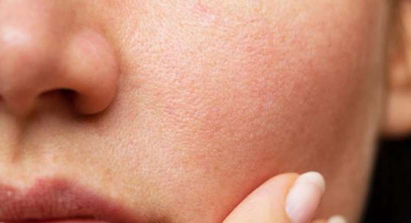 ما سبب اختلاف حجم الخدين