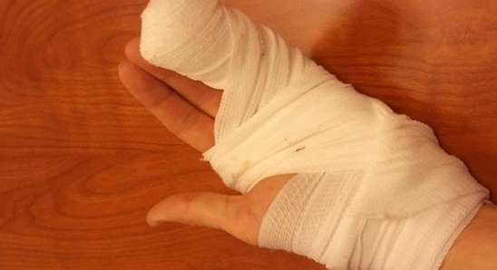 اسعافات اولية لقطع الاصبع | علاج قطع الاصبع
