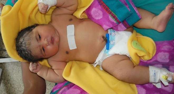 ولادة اكبر طفلة في الهند