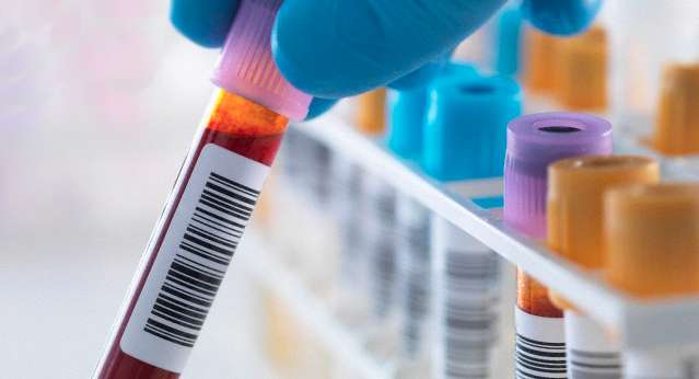 Lab, Plastic