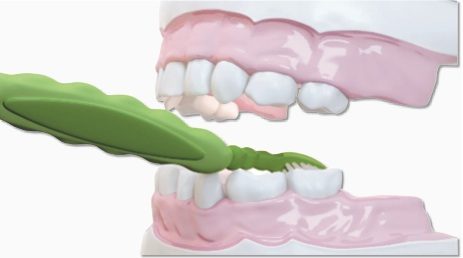 6 خطوات لتنظيف الاسنان