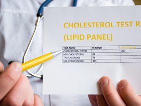 قراءة تحليل الكوليسترول
