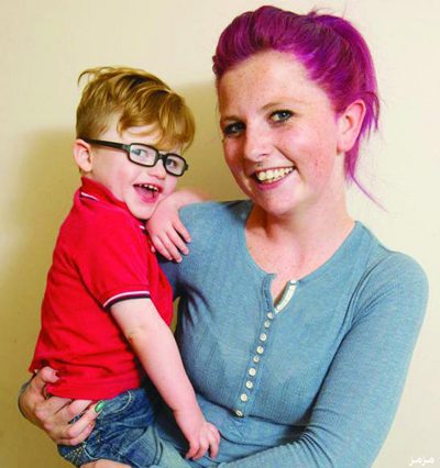 طفل بريطاني يعاني من مرض الإبتسام | صحة، أطفال، أمراض غريبة
