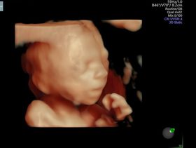 تصوير ثلاثي الابعاد للجنين في الشهر الرابع وشكل الجنين