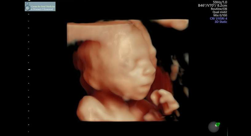 تصوير ثلاثي الابعاد للجنين في الشهر الرابع وشكل الجنين