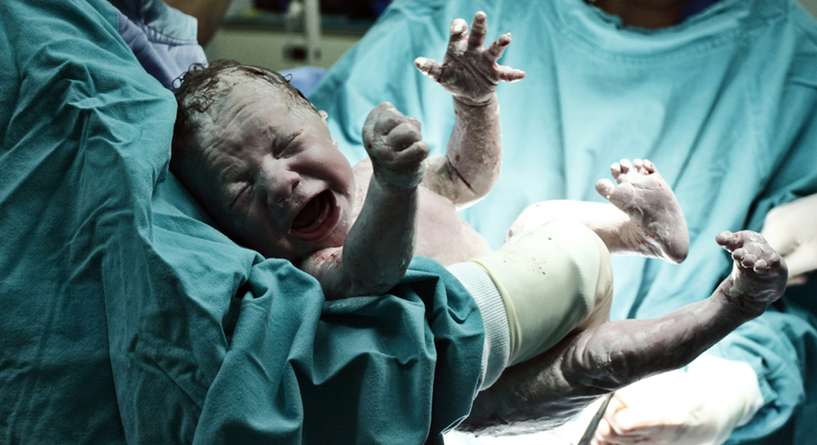 طبيب يكشف عن سبب جديد لارتفاع نسبة الولادة القيصرية