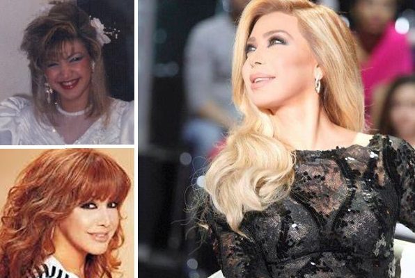 نوال الزغبي قبل تجميل الأسنان