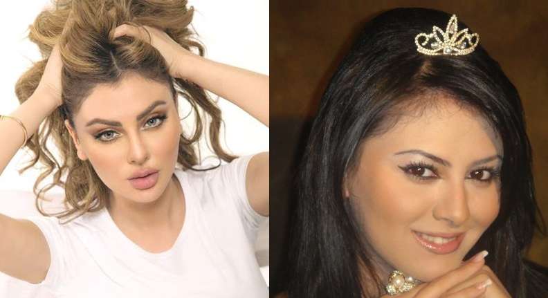 مريم حسين قبل وبعد التجميل