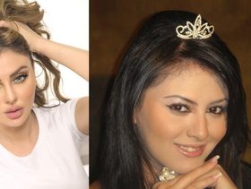مريم حسين قبل وبعد التجميل