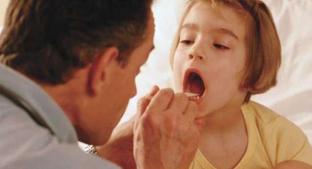 التهاب اللوزتين عند الاطفال