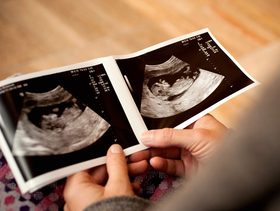 الفرق بين الجنين الذكر والانثى بالسونار في الشهر الثالث