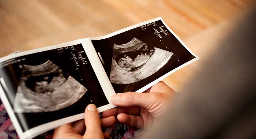 الفرق بين الجنين الذكر والانثى بالسونار في الشهر الثالث