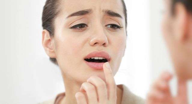 ما علاج الحبوب في الفم واسبابها