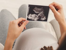 سويت سونار مرتين في اليوم