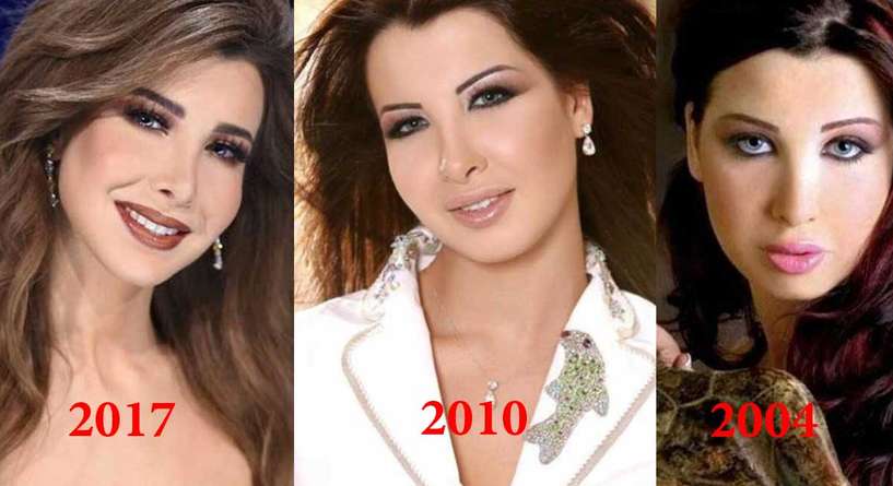 تغيير واضح في ملامح وجه نانسي عجرم وما علاقة زوجها 