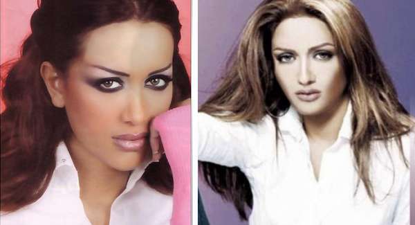 مايا دياب قبل عمليات التجميل