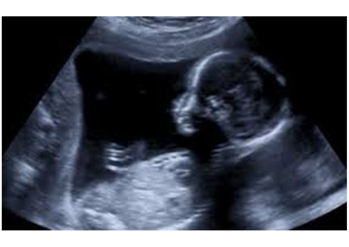 مراحل نمو الجنين في الشهر الثامن بالصور وتغيرات جسمك
