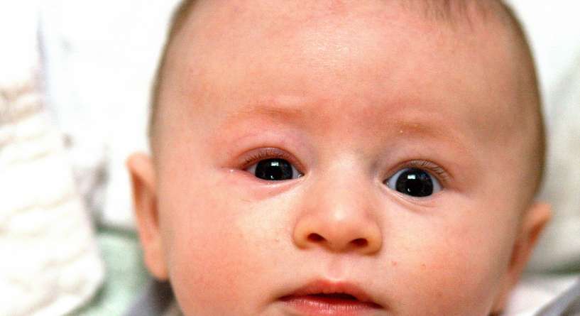 ما هو اهتزاز العين عند الرضيع؟
