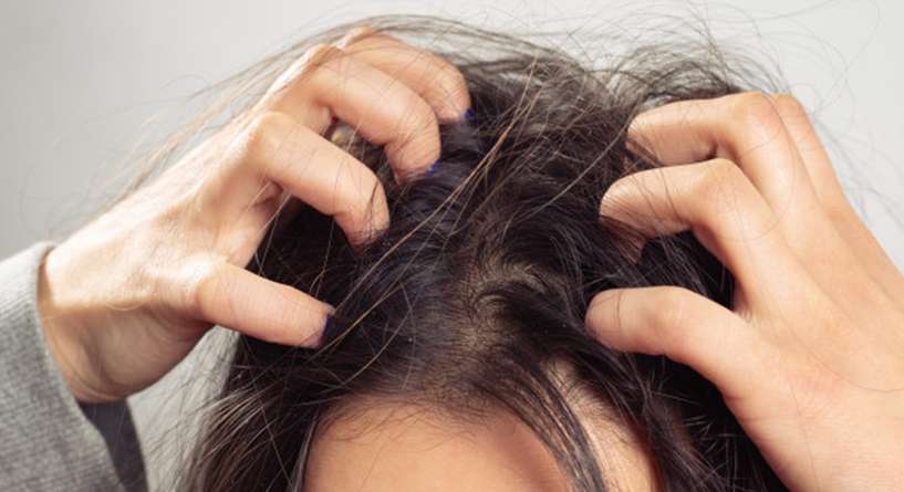 هل حك الراس يسبب تساقط الشعر