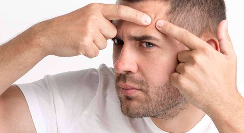 اليك افضل طريقة لازالة الحبوب من الوجه للرجال واسباب ظهورها!