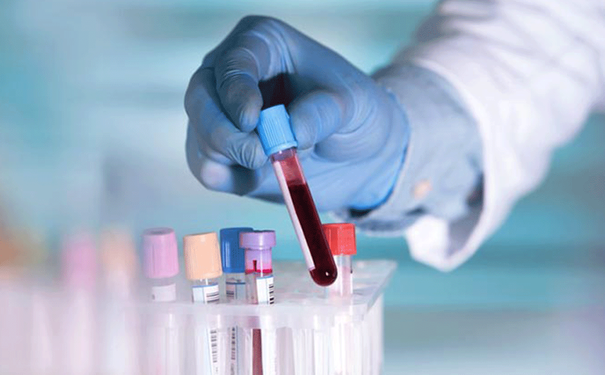 الفرق بين تحليل الحمل الرقمي واختبار الدم