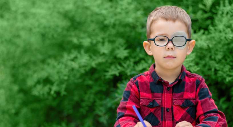 شكل العين بعد عملية الحول