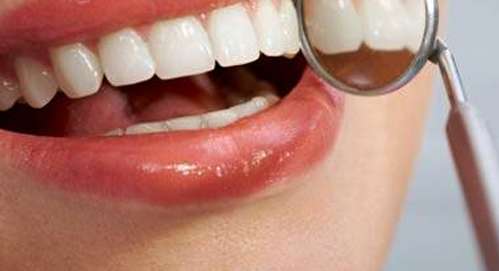 تقويم الاسنان | علاج الاسنان