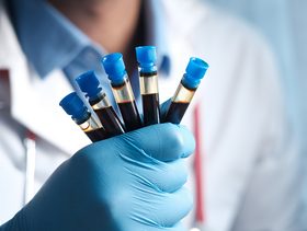 الكولسترول النافع والضار