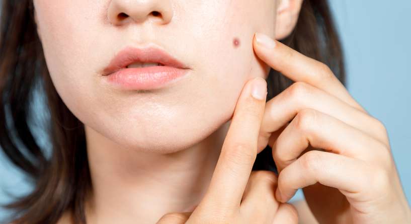 Skin, Person, Human