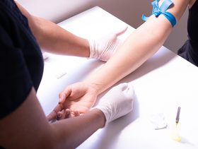 جدول نسب الكوليسترول في الدم