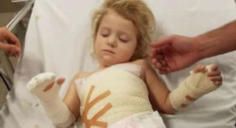 طفلة بعمر 3 سنوات كادت أن تخسر يدها بسبب غرض شائع