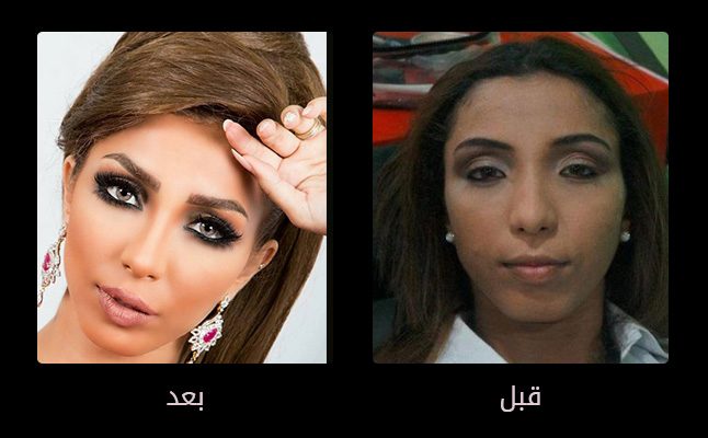 الفنانة دنيا بطمة وعمليات التجميل