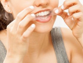 اكتشفي انواع وطريقة استخدام لصقات كرست لتبييض الاسنان!