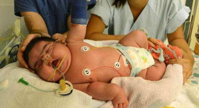 ام في المانيا تضع اكبر طفلة حديثة الولادة بـ ولاده طبيعية