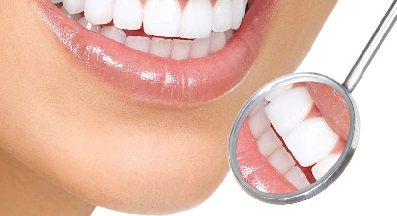 طرق تبييض الأسنان طبيعياً