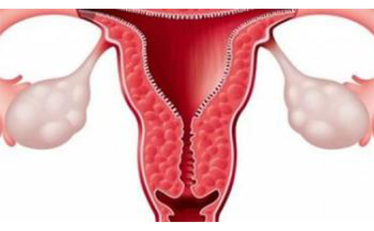 ما هي مشاكل الرحم اثناء الحمل وها تؤثر على الجنين