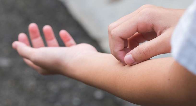 اسباب طفح جلدي عند الاطفال بعد الحرارة