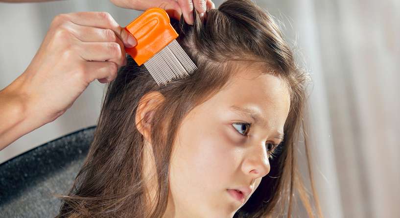 كيفية التعامل مع القمل عند تفشيه في شعر الأطفال وفي المنزل
