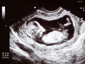  شرح اختصارات اشعة السونار ومعرفة وزن الجنين