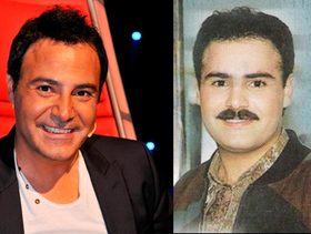 صور فنانون رجال قبل وبعد عمليات التجميل