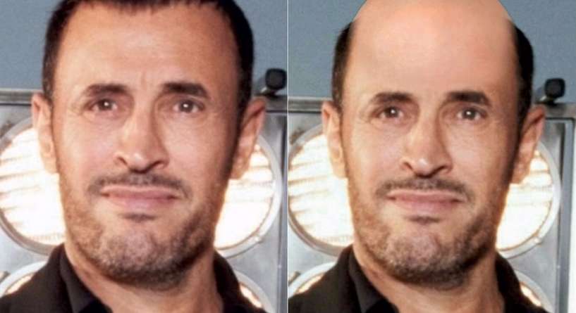 كاظم الساهر لو كان اصلعاً