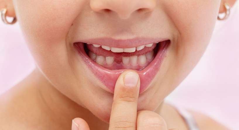 حفظ الأسنان اللبنية للطفل بعد سقوطها