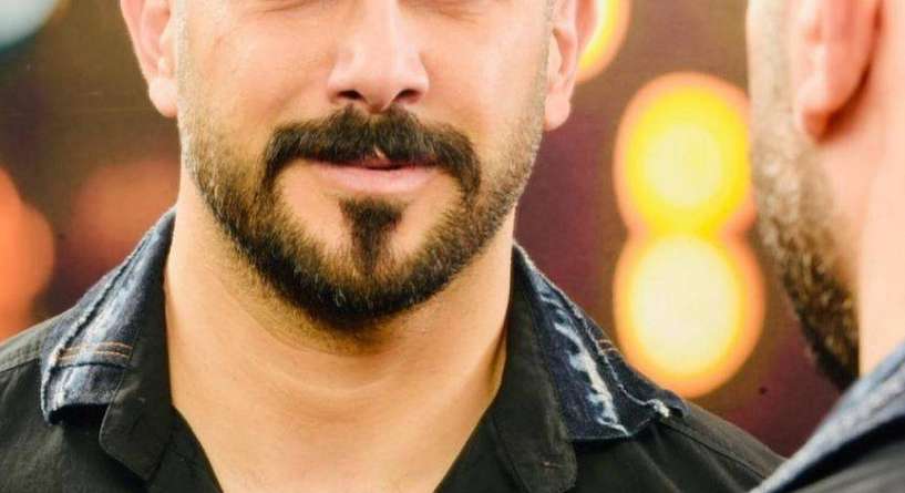 مشاهير رجال عرب فقدوا شعرهم ورزعوها