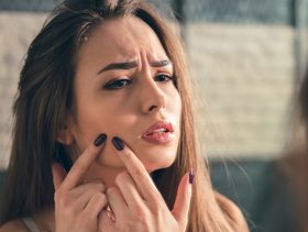 اليك طريقة علاج اثار حب الشباب بسرعة!