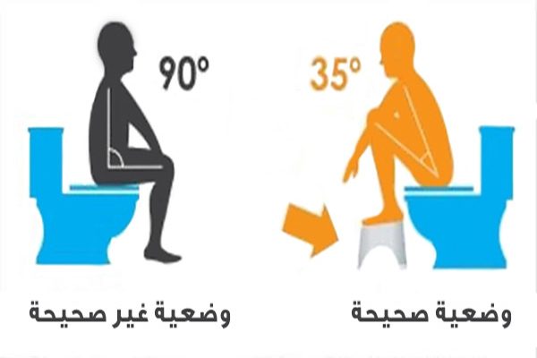 انفوجرافيك حول الوضعية الصحيحة للجلوس على المرحاض