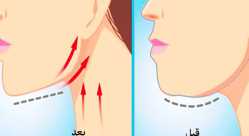 حيلة الشريط اللاصق لشد الرقبة وتنحيفها