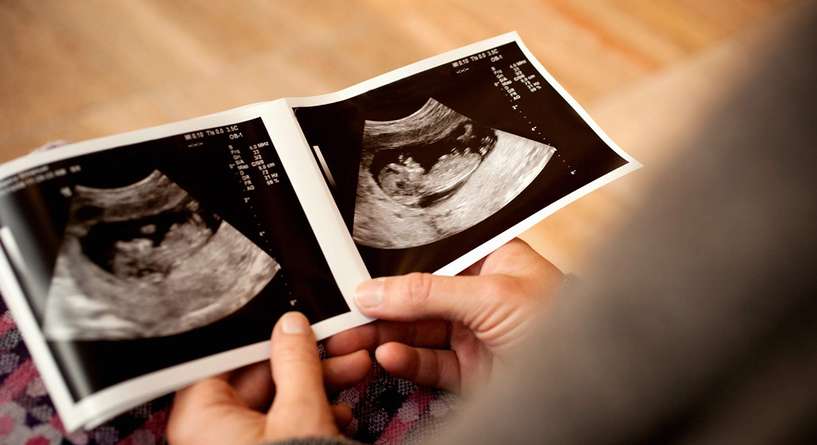كيفية قرأة الرموز في السونار